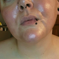 blemishedbeauty Nude