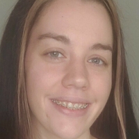bracefacefree Nude