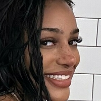 Freckles Nude
