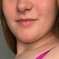 freepennypurge Nude